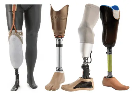 Las prótesis relacionadas con prótesis por encima de la rodilla consisten en una cavidad hecha a medida combinada con un marco de soporte, unidad de rodilla, pilón y pie. A veces también puede ser necesario un manguito o arnés de suspensión. Las rodillas protésicas por encima de la rodilla han evolucionado considerablemente con el tiempo y es primordial la elección correcta de rodilla relevante para la edad, niveles de actividad y estilo de vida.